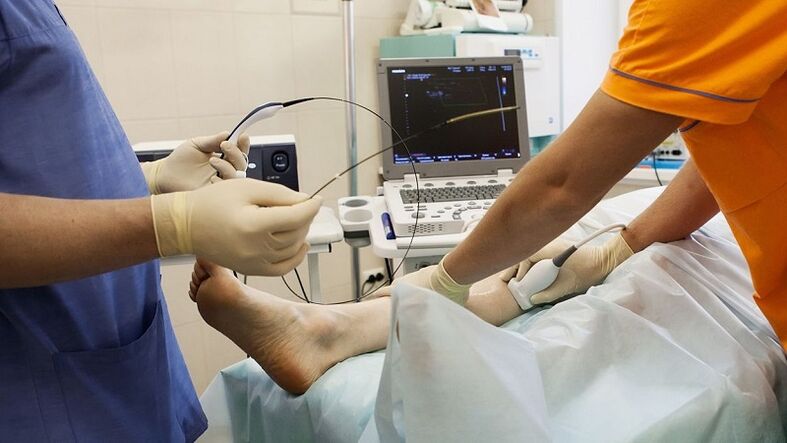 operatsioon veenilaiendite eemaldamiseks